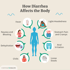 Managing Diarrhea: Tips for Relief and Recovery