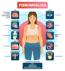 fibromyalgia