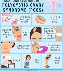 pcos