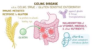 Navigating Life with Celiac Disease: Understanding the Challenges and Triumphs