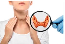 Demystifying Hypothyroidism: Understanding the Underactive Thyroid Condition