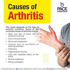 arthritis