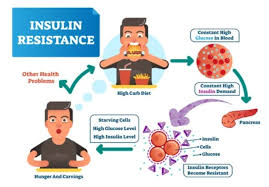 type 2 diabetes