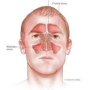 sinus