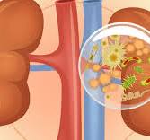 kidney infection