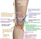 knee pain