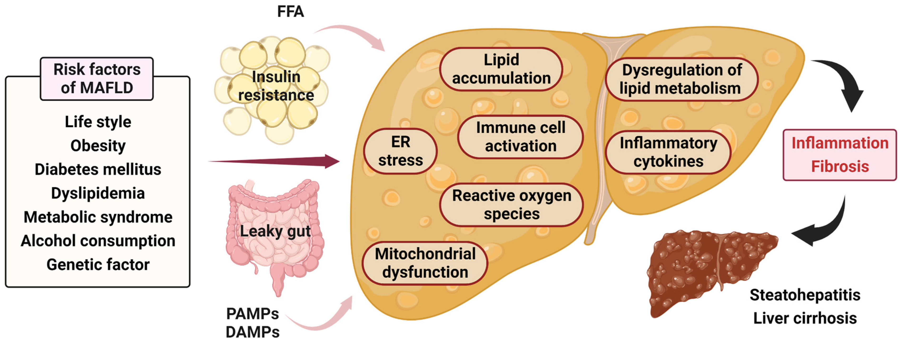 fatty liver disease