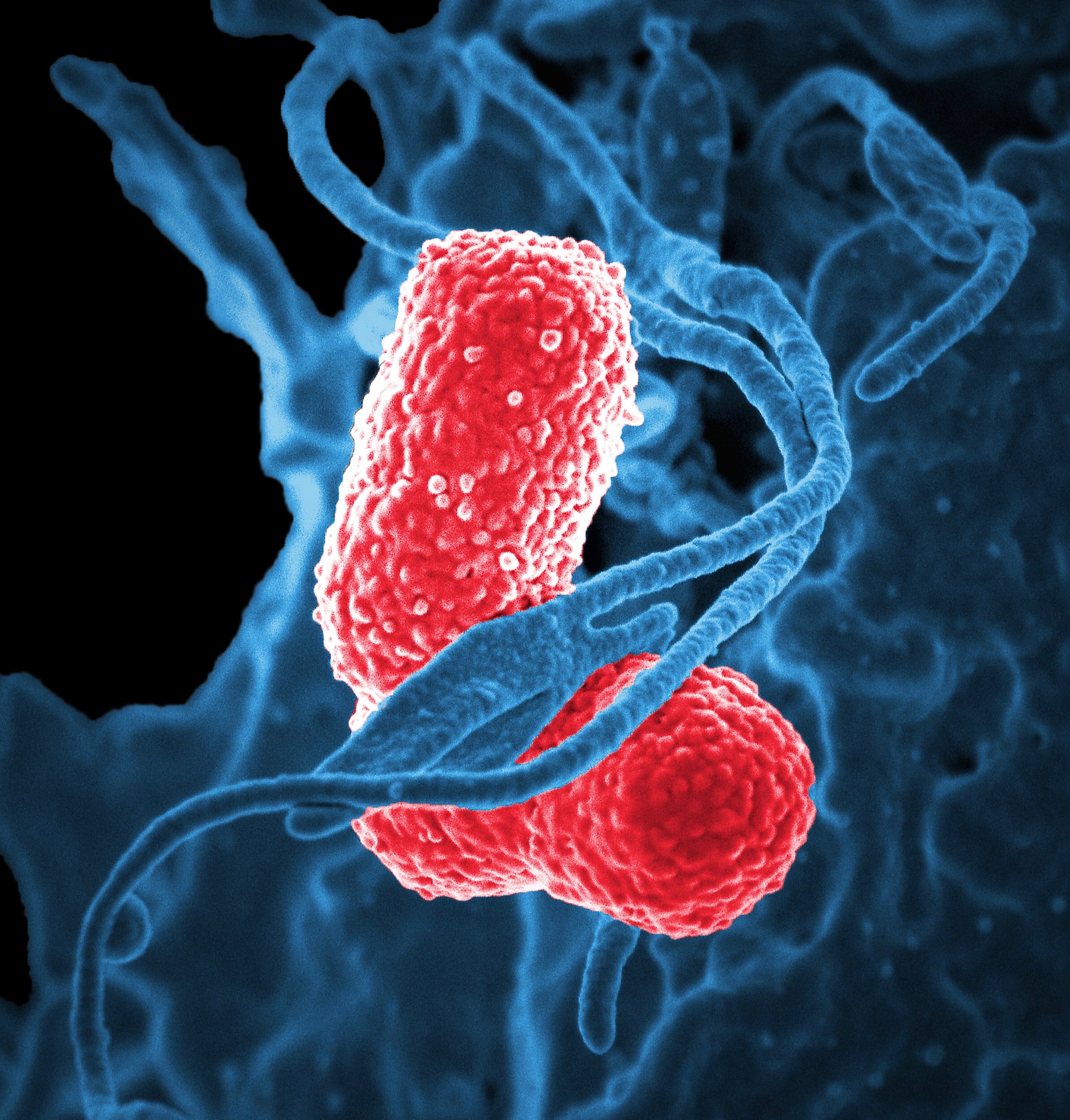 pneumonia treatment