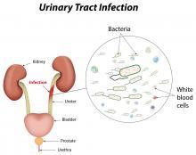 urinary tract infection treatments
